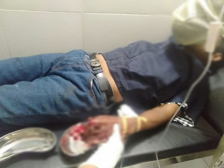 Guru SMA di Manggarai Dibacok Tetangga hingga Luka Parah