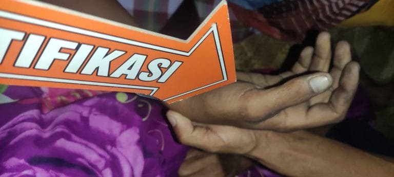 Warga Nagekeo Tewas Tersengat Listrik saat Pasang Umbul-umbul HUT RI